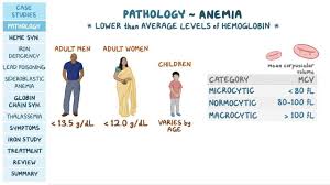 Image result for Microcytic Anemia