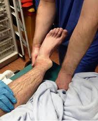 Image result for Ankle Dislocation