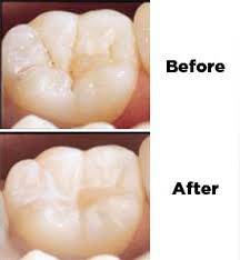 Before & after weight loss. Preventive Dentistry Florham Park Dental Cleanings Pediatric Dentist