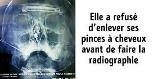 Epingle Sur Anglais