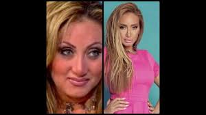 لم تعترف النجمة المصرية شيرين عبد الوهاب بإجراء عملية تجميلية في الأنف، إلا أن الكثير من الصحف والمواقع الالكترونية نشرت لها صوراً ضمن مشاهير العرب قبل وبعد عملية تجميل الأنف، وأكدوا أنها خضعت لأكثر من عملية في الأنف بالإضافة إلى عمليات أخرى في الوجه. Ø±Ø¬ÙŠÙ… Ø±ÙŠÙ‡Ø§Ù… Ø³Ø¹ÙŠØ¯ Ù„ØªØ­Ø¯ÙŠ Ø®Ø³Ø§Ø±Ø© Ø§Ù„ÙˆØ²Ù† ÙŠÙ„Ø§ Ø¨ÙŠÙ†Ø§ Ù†Ø®Ø³ ÙˆÙ†ØµØºØ± ÙˆÙ†Ø­Ù„Ùˆ ÙˆÙ†Ø±Ø¬Ø¹ Ø´Ø¨Ø§Ø¨ Youtube