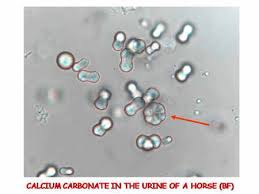 Http Renalcalculi Net Crystals In Urine Html Crystals In Urine Kristally Kamni