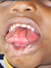 Image result for Tragia incisifolia