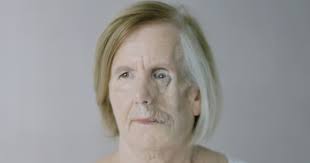 How do we prevent scarring?