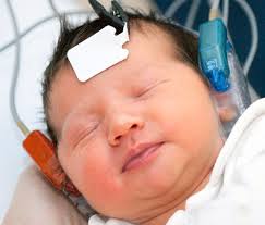 Image result for Pediatric Auditory Screening