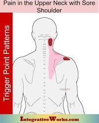 Pin On Neck Trigger Point Pain