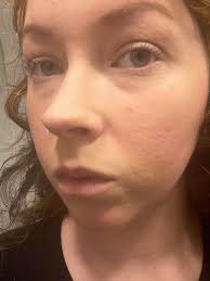 I've never really had an issue with acne as a teen and I don't really wear  makeup often. Along with undiagnosed adhd making any sort of routine very  hard to stick to,