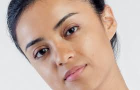 I have mild acne and i even got accutane without a single disagreement. Do Accutane Results Outweigh The Side Effects Realself