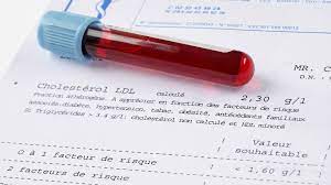 Zusätzlich der preis ist im bezug auf die angeboteten leistung extrem gut. Hohe Cholesterinwerte Richtig Behandeln Ndr De Ratgeber Gesundheit