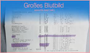 Grosses Blutbild Was Bedeutet Die Blutuntersuchung Leukozyten Info De