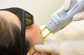 نتیجه تصویری برای لیزر درمانی مو های زائد برای انواع پوست