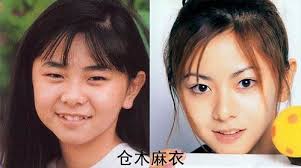 Mai Kuraki before n after surgery