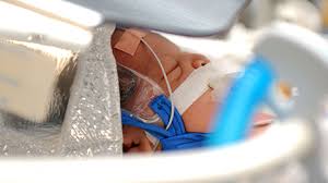 Nicu Tests And Procedures Cs Mott Children S Hospital Michigan Medicine