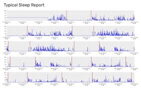 Image result for Actigraphy