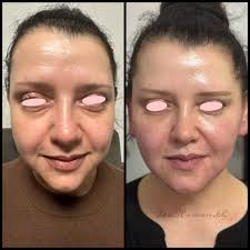 Dr. Rawan Alkhateeb د.روان هشام الخطيب