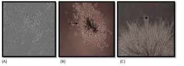Contents preface vii abbreviations xvii 1. Microbial And Viral Contamination Of Animal And Stem Cell Cultures Common Contaminants Detection And Elimination Medcrave Online