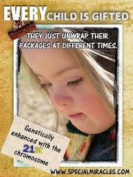 Special Miracles Down Syndrome Down Syndrome Down Syndrome Awareness Month Down Syndrome Awareness