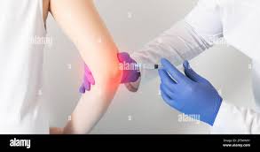 Image result for Elbow Joint Injection