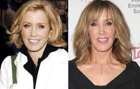 Felicity huffman net worth and how she . Felicity Huffman Plastic Surgery Of Nose Job Facelift Before After Celebritysurgeryicon
