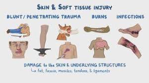 Image result for Skin Trauma