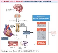 Image result for Autonomic Dysfunction