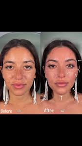 Facial Balancing Transformation with Nurse Nataly Gold