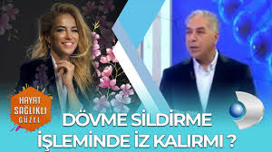 Dovme Sildirme Isleminde Iz Kalirmi Dr Metin Vural Youtube