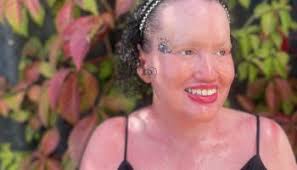 Fiona Patten mentions Face Equality in Victorian Parliament