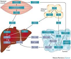 Image result for Cachexia in Cancer