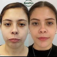 Fabio Faria (@bucomaxcirurgia) • Instagram फोटोहरू र भिडियोहरू