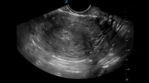 Image result for Ultrasound