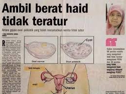 Seharusnya, jika haid teratur, masa subur boleh didapati dengan mudah. Period Tak Teratur Dan Obesiti Punca Rahsia Wanita Hamil Facebook