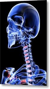 They range in size from the tiniest found in the middle ear, to the largest that forms our thigh.the human body has an amazing array of different bones, many of which you can find on yourself or on a skeleton. The Bones Of The Head Neck And Face Metal Print By Medicalrf Com