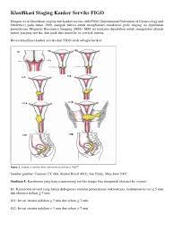 We did not find results for: Klasifikasi Staging Kanker Serviks