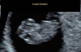 This is the ideal position when. Pregnancy Week 10