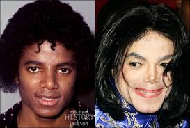 Black or White? Michael Jackson nació con su color de piel negro y con los  años se fue poniendo blanco sin mucha explicación. Los medios de la época  circularon el rumor de