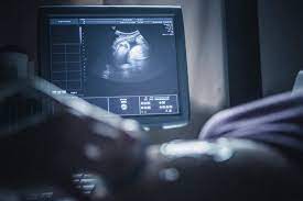If the question is more, is it possible for a baby to be missed in an. When And Why To Get Ultrasounds During Pregnancy The New York Times