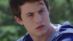 So, this is probably why Clay's head wound never heals in "13 Reasons Why" 