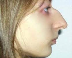 Pin By Qwerasdf9876 On To Do Photoshop Pretty Nose Big Nose Beauty Big Nose Girl