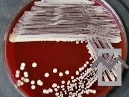 Image result for Staphylococcus Saprophyticus