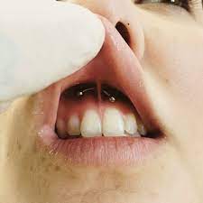 Body Piercing Is An Art That Can Enhance The Look Of Human Body These Are Some Of The Major Types Of Bo Mouth Piercings Types Of Body Piercings Body Piercings