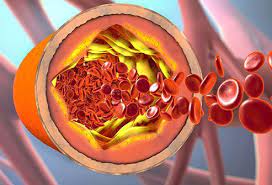 At normal levels, it is an essential substance for the body. Cholesterol Level Charts Normal High Low Levels Results
