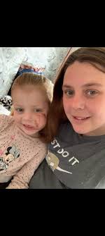 An XL Bully disfigured my daughter