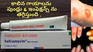 We earn a commission for products purchased through some links in this article. Allergies And Skin Burns With Soframycin Cream In Allopathic In Telugu L Wounds L Scabies L Nails Youtube