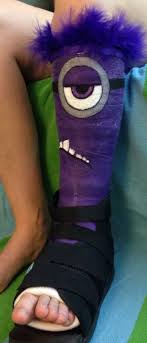 30 Pieces Of Cast Art That Almost Make A Broken Bone Worth It Cast Art Leg Cast Arm Cast