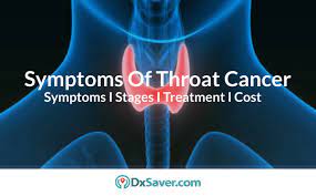 Trouble swallowing is one of the first reported symptoms of throat cancer. Symptoms Of Throat Cancer More About Early Signs Stages Treatment