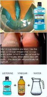 How do you make a foot spa? Get Summer Ready Natural Skin Care Beauty Skin Care Health And Beauty Tips