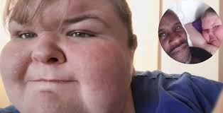 Fans give tammy a warning, jerry married? 1000 Lb Sisters Was Jerry Sykes Forced To Be On The Show