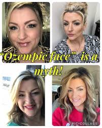 Before and after! One year later! You can accomplish everything you dream  of in one year! Never give up