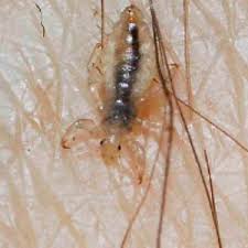 So let's dig into what candida overgrowth is, why it leads to such terrible itching, and how to eliminate it. Itching Down There 8 Facts You Should Know About Pubic Lice Health24